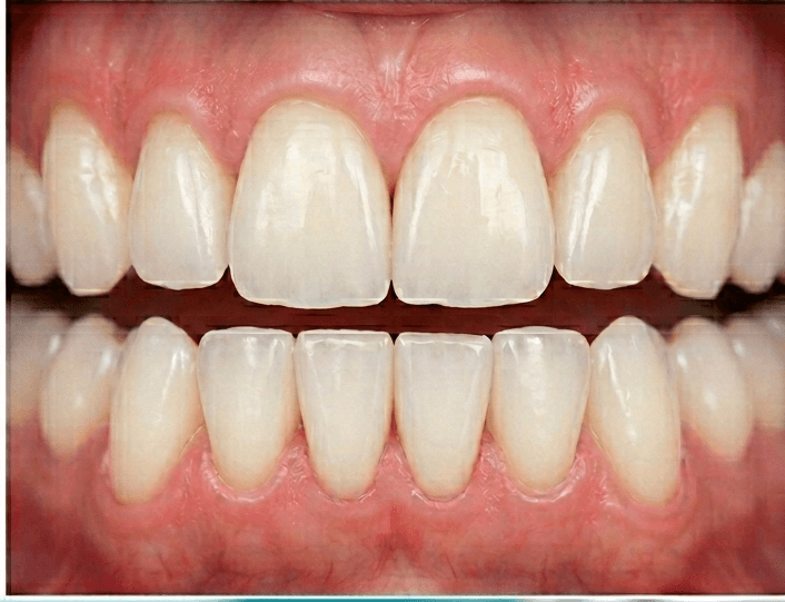 After treatment