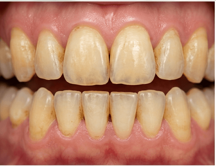 Before treatment